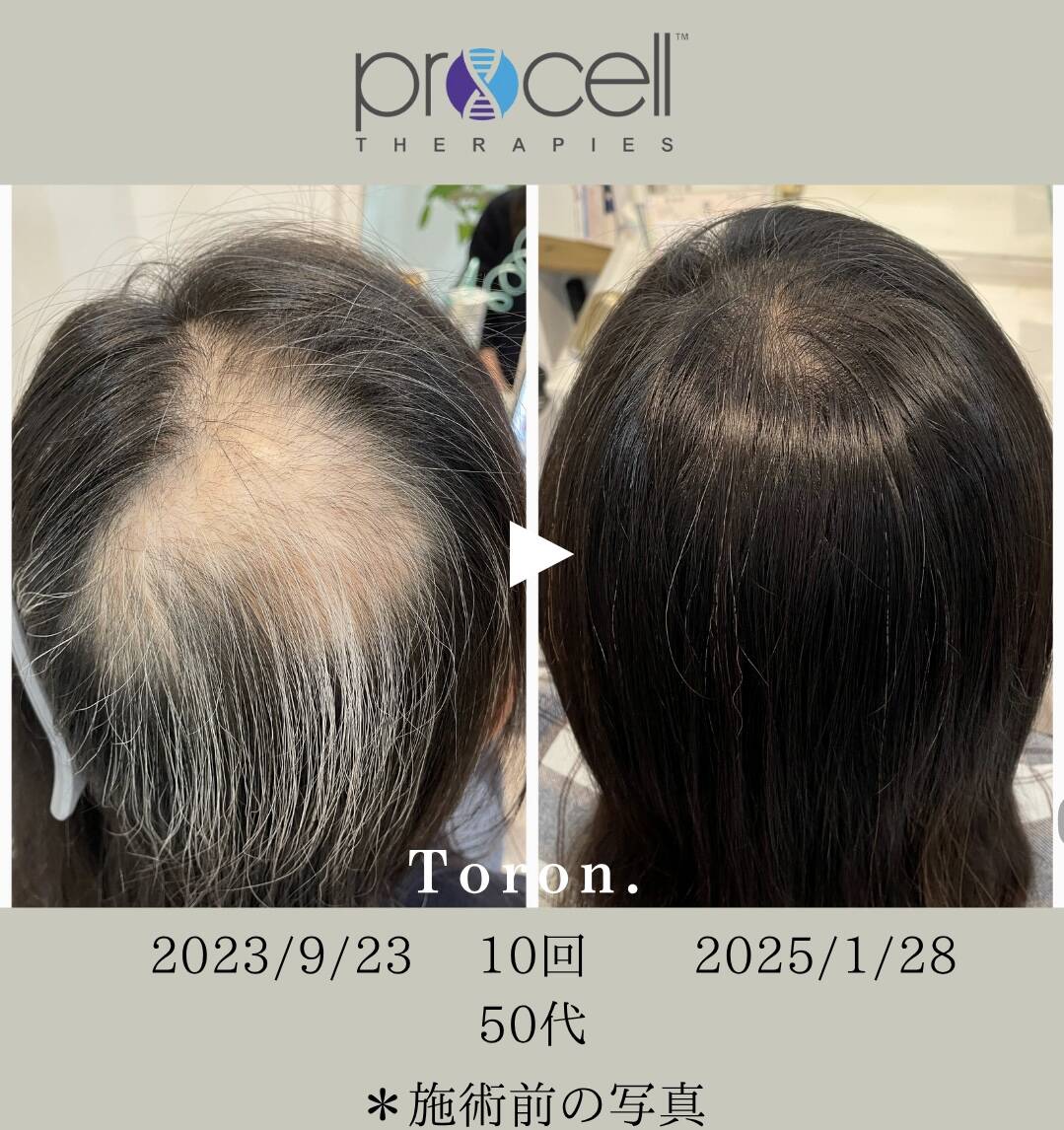 procell theraples プロセルセラピーズ | Toron.
